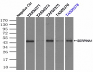 AM33397PU-N - Alpha-1-antitrypsin