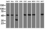 AM33397PU-N - Alpha-1-antitrypsin