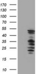 AM33399PU-N - SERPINB2 / PAI2