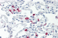 AM33402PU-N - CD289 / TLR9