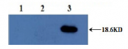 AM33424PU-N - Interleukin-10 / IL10