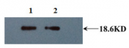 AM33425PU-N - Interleukin-10 / IL10