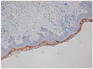 AM33434PU-N - RNASE7