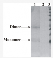AM33444PU-N - Neurturin