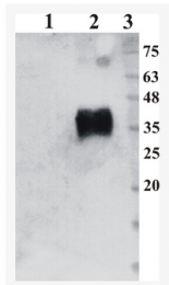 AM33447PU-N - Artemin