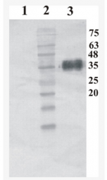 AM33448PU-N - Artemin