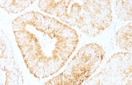 AM33491PU-S - Interleukin-6 / IL6