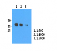 AM39075PU-N - Influenza A H1N1