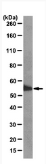 AM39079PU-N - ABI1 / SSH3BP1