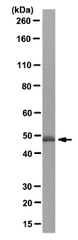 AM39125PU-N - Isocitrate dehydrogenase / IDH2