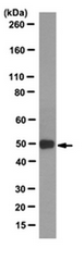 AM39126PU-N - Isocitrate dehydrogenase / IDH