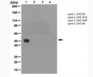 AM39126PU-N - Isocitrate dehydrogenase / IDH
