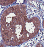 AM39143PU-N - BNIPL