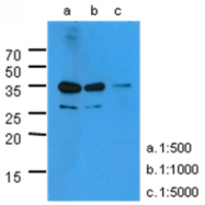 AM50013PU-N - Kallikrein-3 / PSA / KLK3