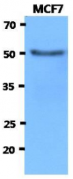 AM50044PU-N - Beta-hexosaminidase alpha / HEXA