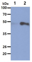 AM50044PU-N - Beta-hexosaminidase alpha / HEXA