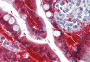AM50085PU-N - Galectin-3