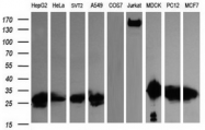 AM50085PU-N - Galectin-3