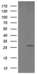 AM50085PU-N - Galectin-3