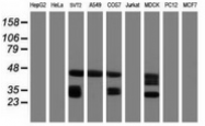 AM50086PU-N - CD20