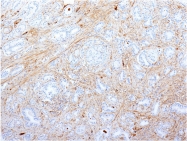 AM50111PU-S - Fibronectin