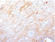 AM50112PU-S - Fibronectin