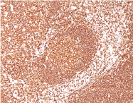 AM50230PU-S - CD45 / LCA
