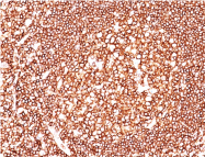 AM50230PU-S - CD45 / LCA