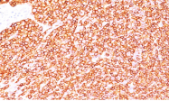 AM50232PU-S - CD45 / LCA