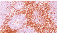 AM50243PU-S - CD6