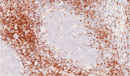 AM50243PU-S - CD6