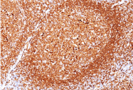 AM32862PU-S - CD79a