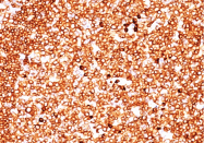 AM50250PU-S - CD79a
