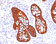 AM50256PU-S - Cytokeratin 19
