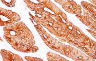 AM50258PU-S - Cytokeratin 8