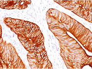 AM50259PU-S - Cytokeratin 8