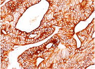 AM50261PU-S - Cytokeratin 8/18