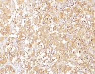 AM33241PU-S - Melanoma gp100