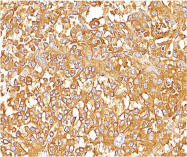 AM33241PU-S - Melanoma gp100