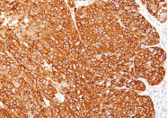 AM50296PU-S - Melanoma Marker (MART-1 + Tyrosinase + gp100)