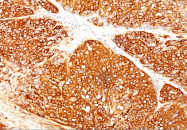 AM50297PU-S - Melanoma Marker (MART-1 + Tyrosinase + gp100)