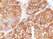 AM50298PU-S - Melanoma Marker (MART-1 + Tyrosinase + gp100)