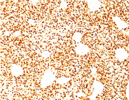 AM50302PU-S - Myogenin