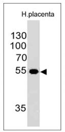 AM50303PU-N - Ornithine decarboxylase