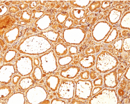 AM50315PU-S - Thyroglobulin