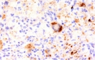 AM50317PU-S - Tumor necrosis factor (TNF-alpha)