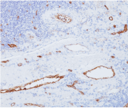 AM50326PU-S - von Willebrand factor (VWF)