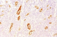 AM50326PU-S - von Willebrand factor (VWF)