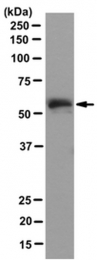 AM50381PU-N - ABI1 / SSH3BP1