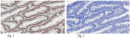 AM50442PU-N - RPA2